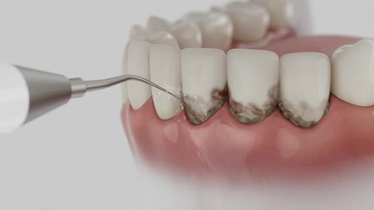 Reliable Root Canal Treatment contractor in Callahan County County, TX by Dentist Open Now